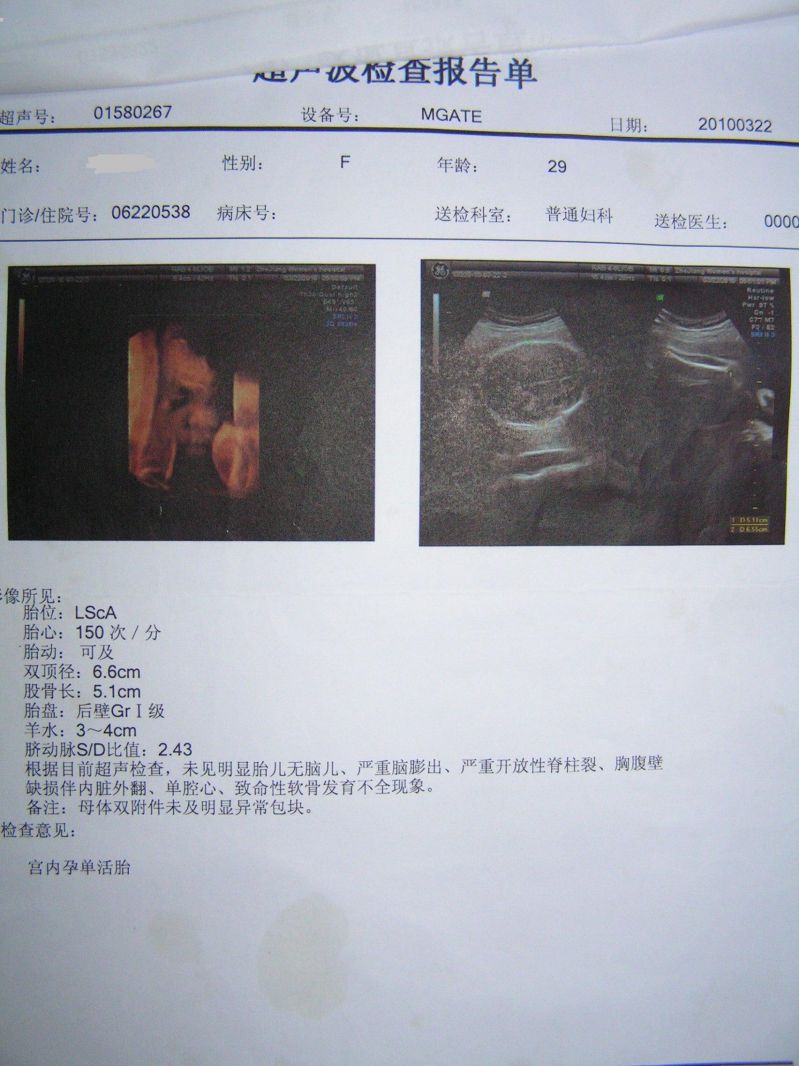 借卵试管婴儿排卵会伤害卵巢功能吗？