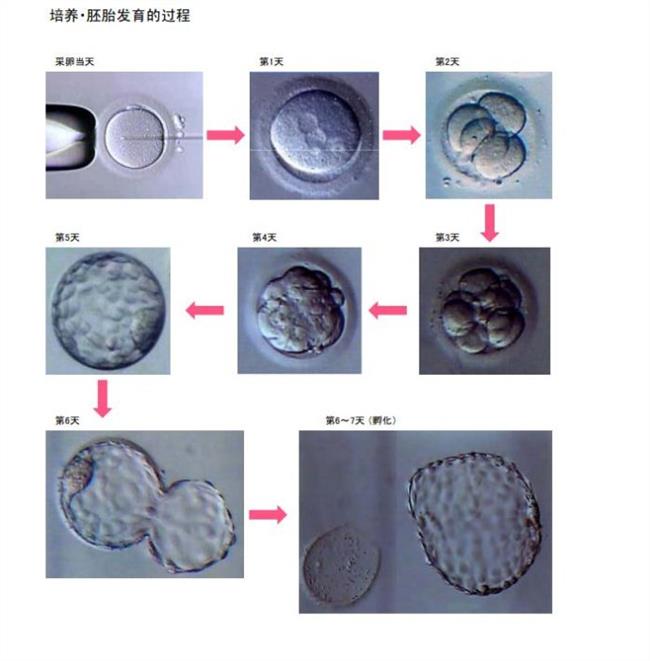 供卵试管婴儿对男性伴侣的精子指标有哪些要求？提高精子质量的方法