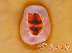 贵阳借卵试管供卵代怀和万科选择e