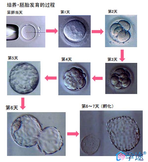供精试管的费用是多少？它到底贵不贵？