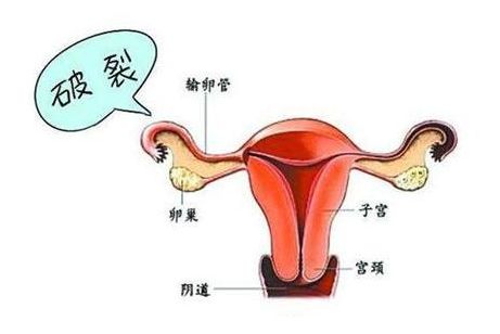 如果我想生双胞胎，而且我已经28岁了，没有不良健康记录，可以做赠卵供卵试管三代吗？