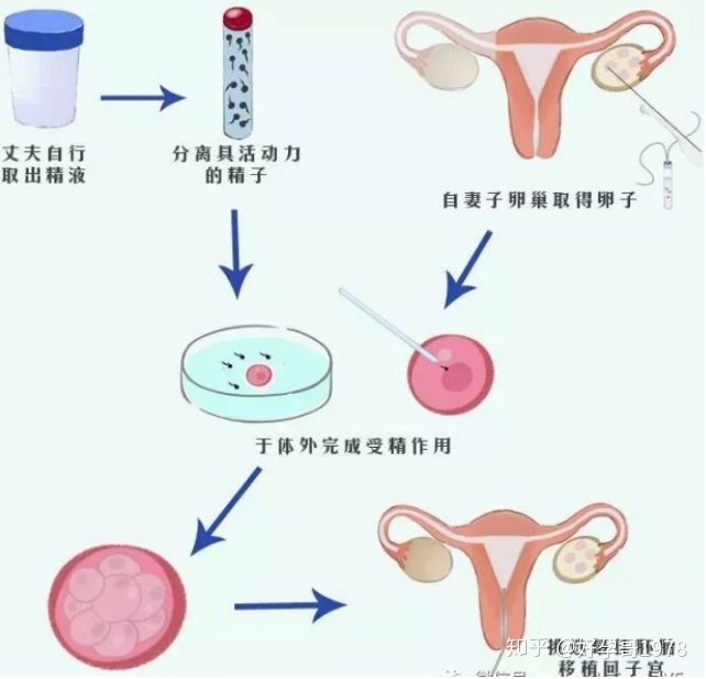 因卵巢早衰而不排卵，该怎么办？我可以做供卵代生三代试管吗？