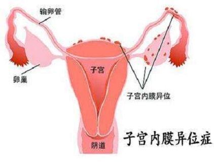 胎儿21号染色体异常是因为精子有问题吗？
