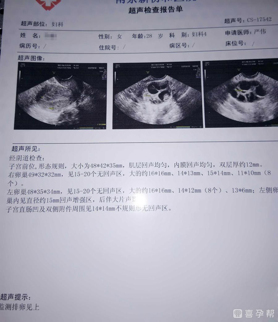 兔子人工授精需要注意什么+兔子人工授精需要是步骤